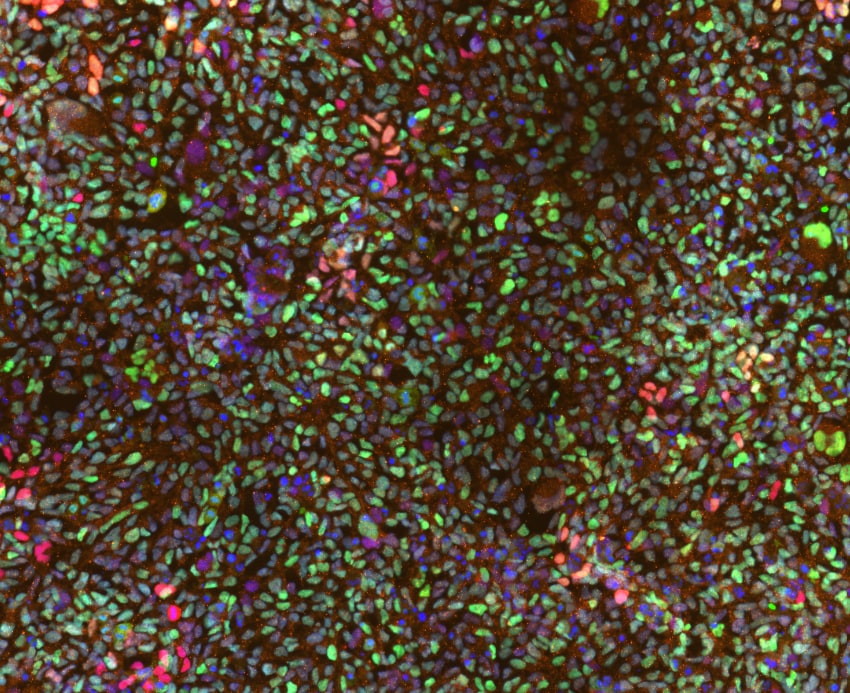 Human HNF‑3 beta /FoxA2 Antibody AF2400